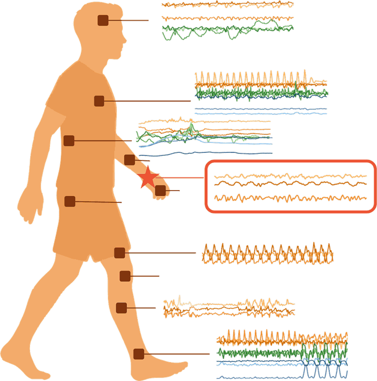 Inertia-1 teaser: a wrist-worn accelerometer model transferring to sensors across the body